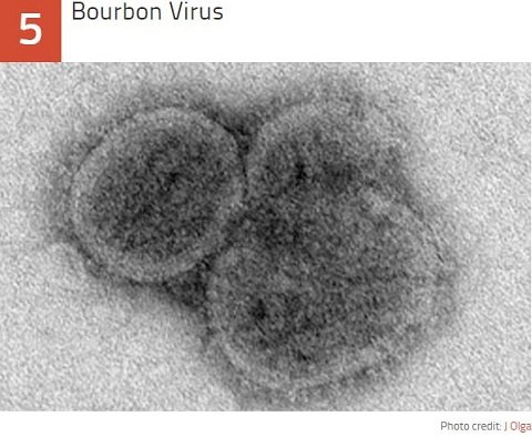 未だ解明されない謎の激ヤバな最凶ウイルス10！ 出血、発熱、死亡…アウトブレイクで人類滅亡!?の画像6