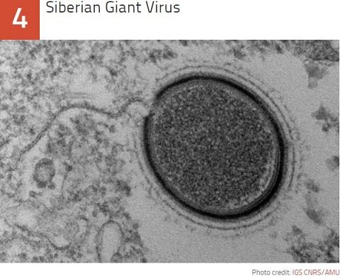 未だ解明されない謎の激ヤバな最凶ウイルス10！ 出血、発熱、死亡…アウトブレイクで人類滅亡!?の画像7