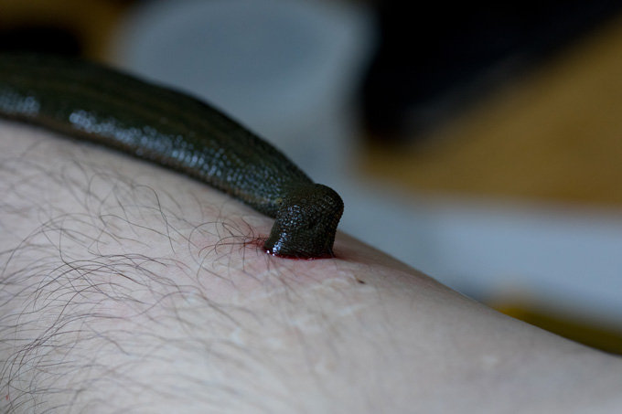 【閲覧注意・インタビュー】世界最大の吸血ヒルを育てた男、ヤバすぎる吸血現場を生披露！ ヒルとの出会いを語り尽くす！の画像9