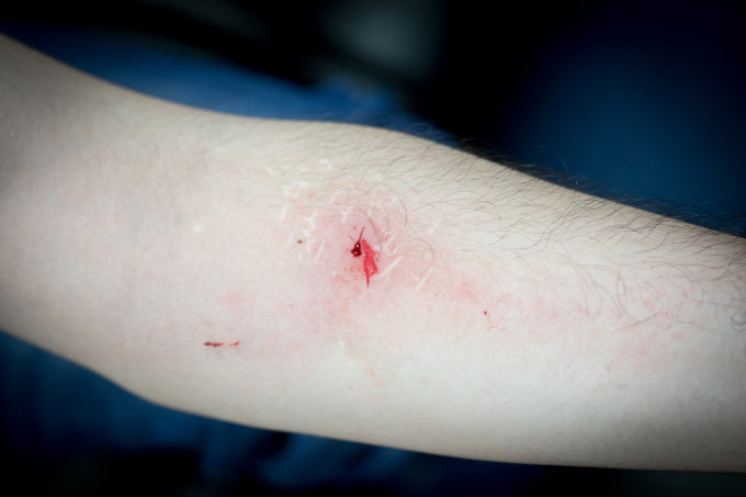 【閲覧注意・インタビュー】世界最大の吸血ヒルを育てた男、ヤバすぎる吸血現場を生披露！ ヒルとの出会いを語り尽くす！の画像6