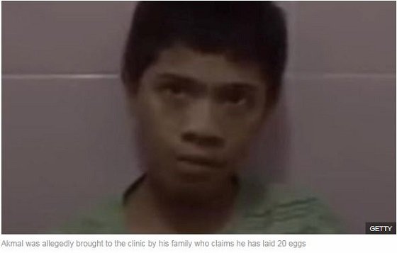 2年間で20回「産卵した」14歳少年！ レントゲンにも映り込み… 謎の卵に家族戦慄＝インドネシアの画像2