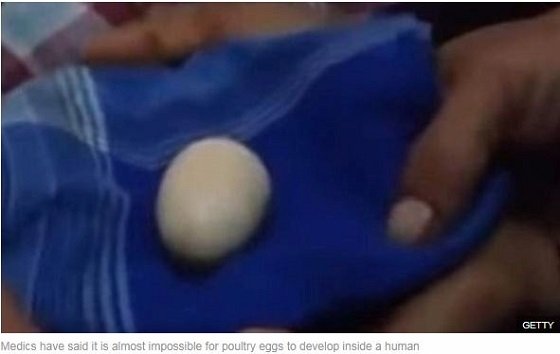 2年間で20回「産卵した」14歳少年！ レントゲンにも映り込み… 謎の卵に家族戦慄＝インドネシアの画像3