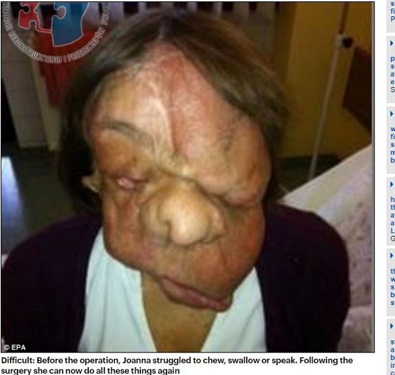 【閲覧注意】顔面ドロドロ女、顔を取り替えて超絶美女に大変身！ 手術映像が壮絶すぎる!!の画像1