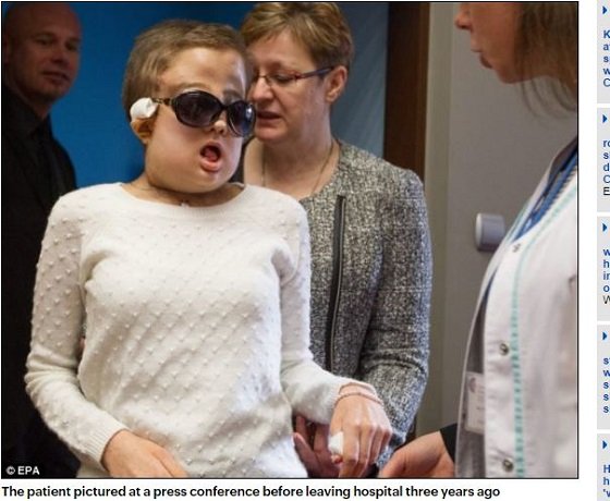 【閲覧注意】顔面ドロドロ女、顔を取り替えて超絶美女に大変身！ 手術映像が壮絶すぎる!!の画像2