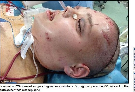 【閲覧注意】顔面ドロドロ女、顔を取り替えて超絶美女に大変身！ 手術映像が壮絶すぎる!!の画像4