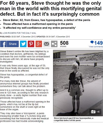 「オレは世界一の短小」2.5センチの男性器をもつ男の苦し過ぎる人生　まさかの切断も…の画像1