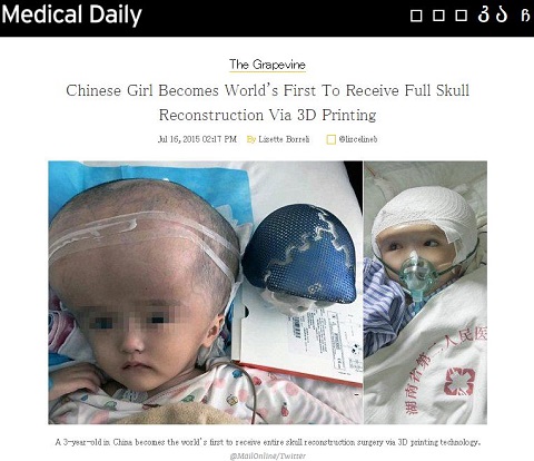 2015年の画期的治療法ベスト7！　脳への直接コミュニケーション、男性器移植…！の画像2