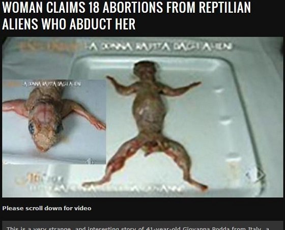 【衝撃画像】人間と爬虫類型宇宙人のハイブリット胎児を18回中絶した女「4歳からずっとレイプされた」の画像1
