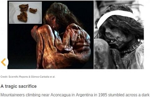 腰から歯が生えた女、人骨を栄養にする木…世界のゾッとする考古学的発見10選！の画像1