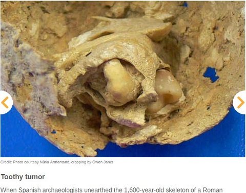 腰から歯が生えた女、人骨を栄養にする木…世界のゾッとする考古学的発見10選！の画像3