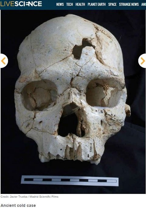 腰から歯が生えた女、人骨を栄養にする木…世界のゾッとする考古学的発見10選！の画像8