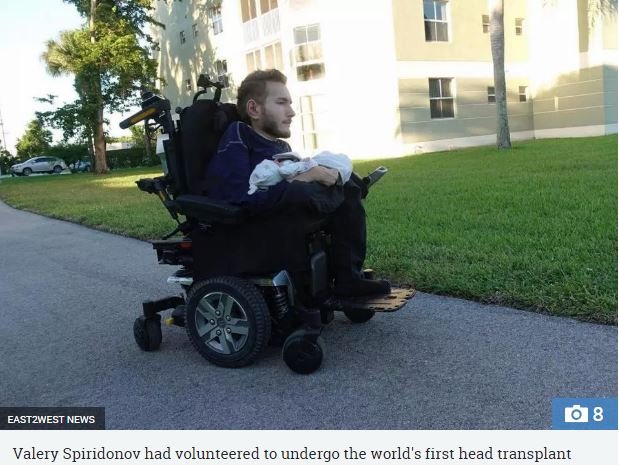 世界初「頭部移植手術」の希望者がまさかのドタキャン！ 怖気づいたのではなく… リア充すぎる中止理由に衝撃！の画像1