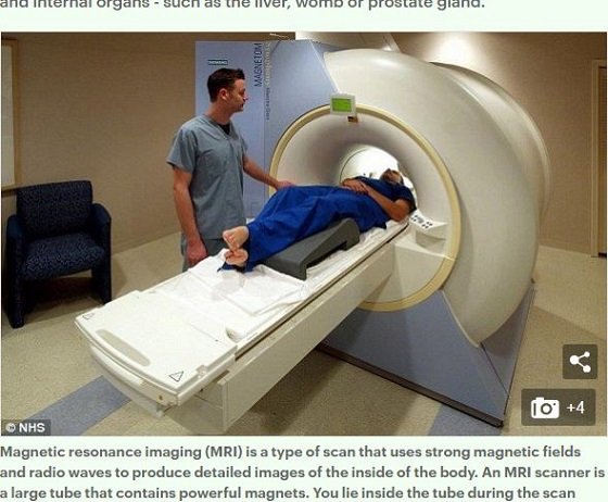 「顔がデカい人＝脳もデカくて地頭が良い」ことが判明！ 流動性知能に差… 長年の議論についに結論の画像2
