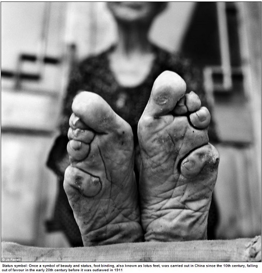 変形したつま先、折り畳まれた指…中国最後の纏足女性が写真集にの画像1