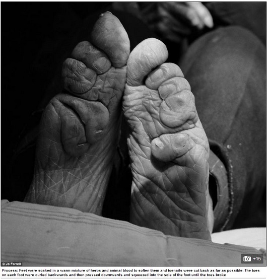変形したつま先、折り畳まれた指…中国最後の纏足女性が写真集にの画像3