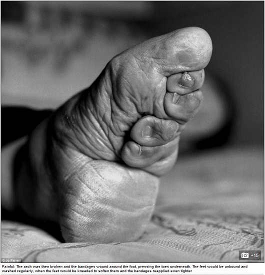 変形したつま先、折り畳まれた指…中国最後の纏足女性が写真集にの画像4
