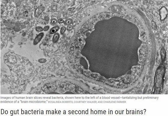 腸内細菌ならぬ「脳内細菌」が発見される！ 研究者も唖然、ヒトの脳は無菌状態ではなかった!!の画像2