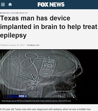 「犯罪者の脳を手術すべき」vs「犯罪者と我々の脳は同じ」の画像1