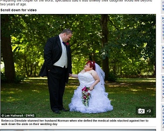 全身の骨が折れた花嫁 ― 身長110cmのレベッカが歩いた感動のバージンロードの画像2