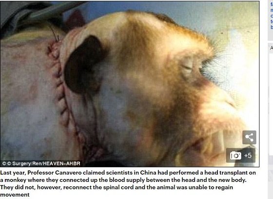 「頭部移植手術を10カ月以内、冷凍脳移植手術も2020年までに実行」現代のフランケンシュタイン博士が死の根絶を宣言、各界に波紋の画像1