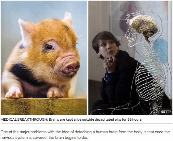 「脳だけで生きる豚」の実験成功、次は人間で実験!?「肉体のない脳は、死ぬより苦痛な運命」大学教授が警鐘の画像1