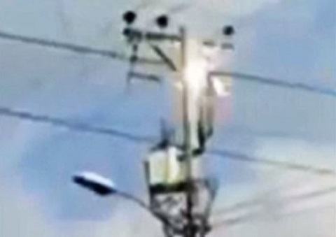 1万3000ボルトに感電したが一命を取り留めた男の哀愁漂う顔とは？の画像1