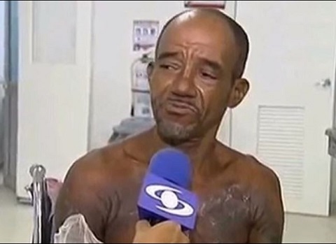 1万3000ボルトに感電したが一命を取り留めた男の哀愁漂う顔とは？の画像2