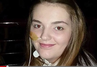 エーラス・ダンロス症候群 ― 身体がバラバラになる少女は口も縫い合わせる＝イギリスの画像1