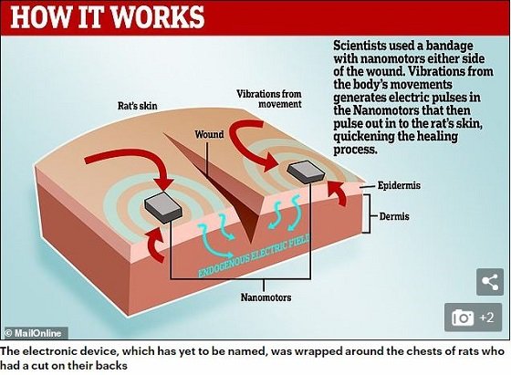 電流でビビビッと傷を4倍早く治す「電子ばんそうこう」爆誕へ！ もはや湿潤療法も時代遅れ！の画像2