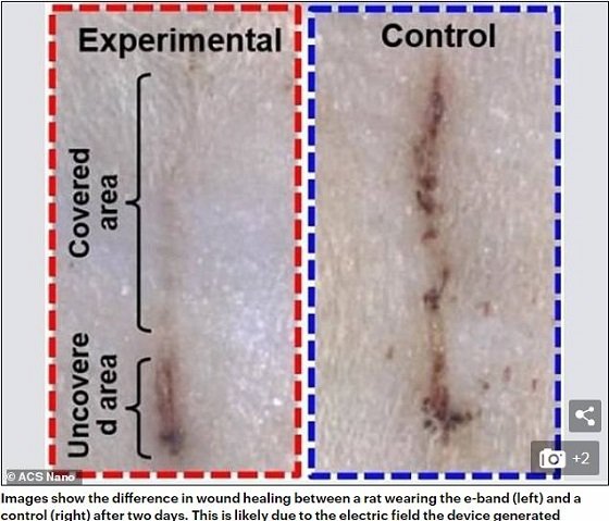 電流でビビビッと傷を4倍早く治す「電子ばんそうこう」爆誕へ！ もはや湿潤療法も時代遅れ！の画像3