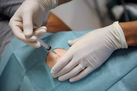 エンドモルフィン ― モルヒネと同じ効果で依存性・副作用がない夢の新麻薬の画像2