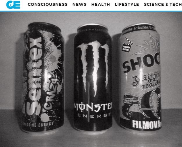 エナジードリンクの飲み過ぎで脳が半分になったサラリーマン ― 額は完全消失、全くの別人にの画像1