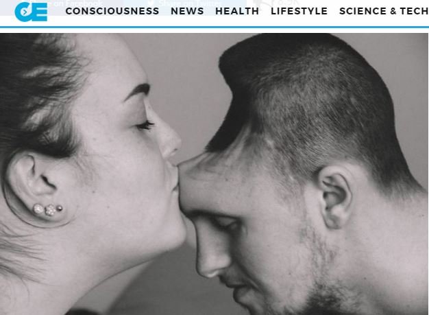 エナジードリンクの飲み過ぎで脳が半分になったサラリーマン ― 額は完全消失、全くの別人にの画像2