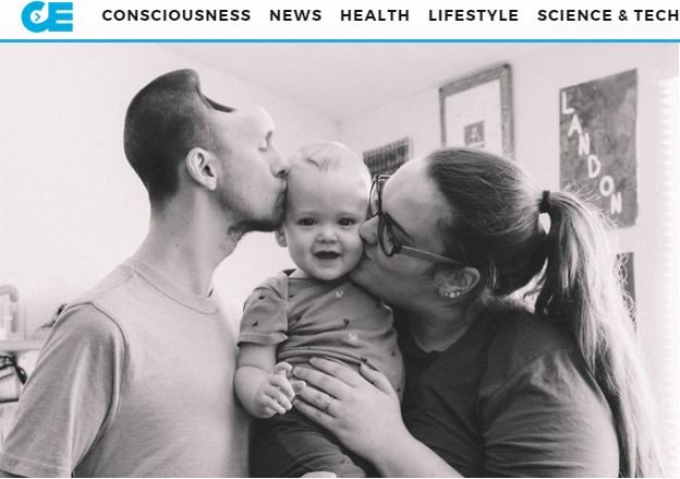 エナジードリンクの飲み過ぎで脳が半分になったサラリーマン ― 額は完全消失、全くの別人にの画像3