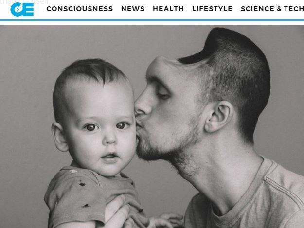 エナジードリンクの飲み過ぎで脳が半分になったサラリーマン ― 額は完全消失、全くの別人にの画像4