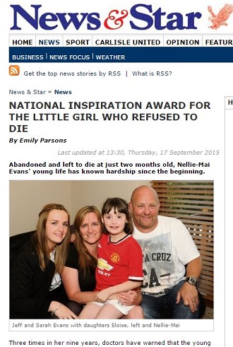 愛する我が子がチャッキーになっていく！ 恐怖の皮膚疾患「EBウイルス」と闘う子どもたちの画像1