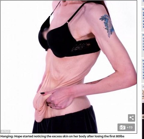 150キロ→56キロへ！ 90キロ激ヤセした女性が払った凄まじい代償とは!?の画像3