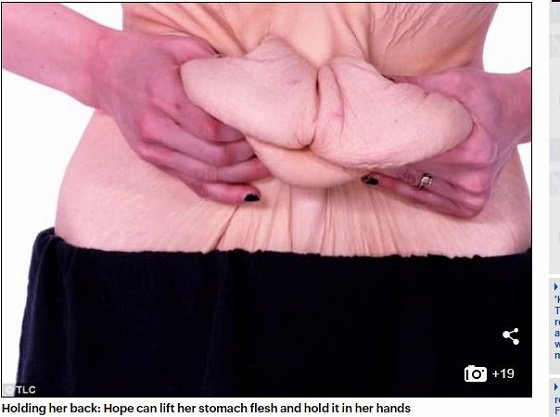 150キロ→56キロへ！ 90キロ激ヤセした女性が払った凄まじい代償とは!?の画像4