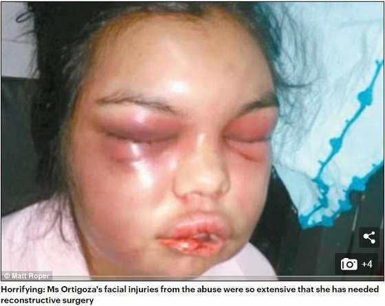 美人妻のフェイスブックが「いいね」される度にボコボコに殴り続けた鬼畜夫！ 一体なぜ… パラグアイ農村に残るマチスモがDVの原因かの画像2