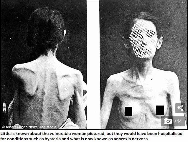 19世紀フランスの精神病院で撮影された女性患者5名の写真に衝撃！ どんな病気も「ヒステリー」と診断、強制収容＆子宮摘出の画像1