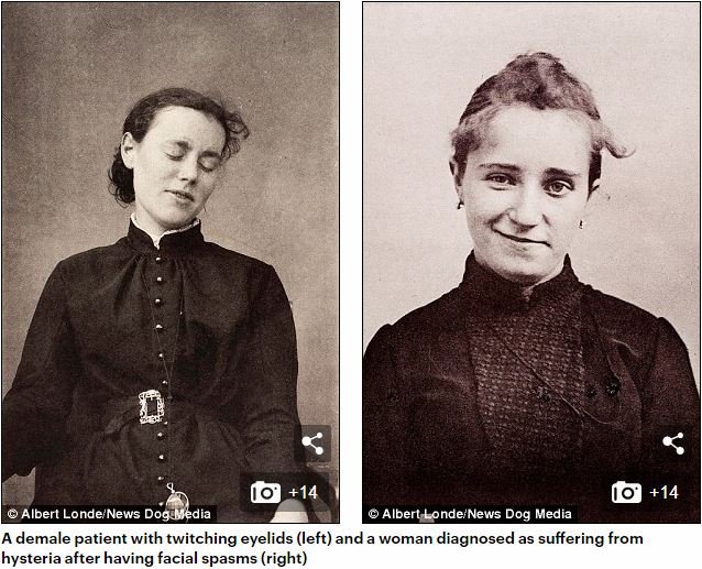 19世紀フランスの精神病院で撮影された女性患者5名の写真に衝撃！ どんな病気も「ヒステリー」と診断、強制収容＆子宮摘出の画像2