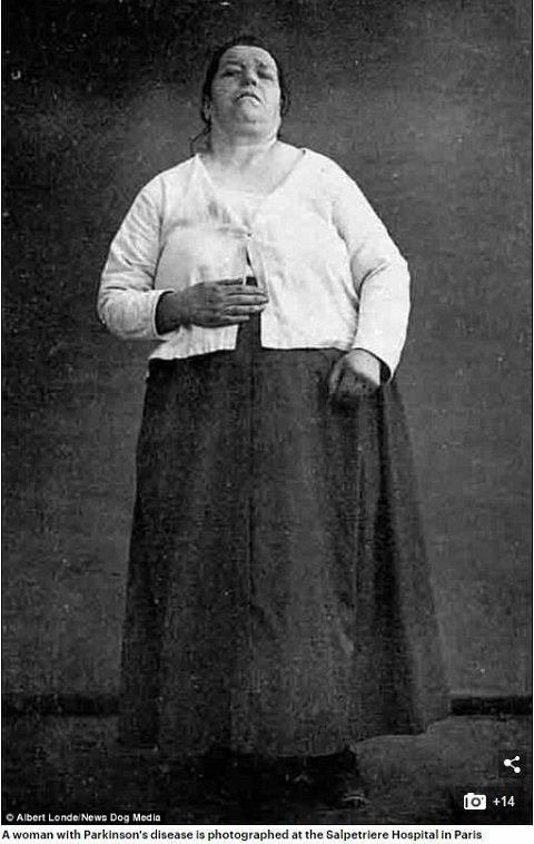 19世紀フランスの精神病院で撮影された女性患者5名の写真に衝撃！ どんな病気も「ヒステリー」と診断、強制収容＆子宮摘出の画像3