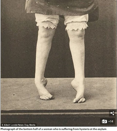 19世紀フランスの精神病院で撮影された女性患者5名の写真に衝撃！ どんな病気も「ヒステリー」と診断、強制収容＆子宮摘出の画像8