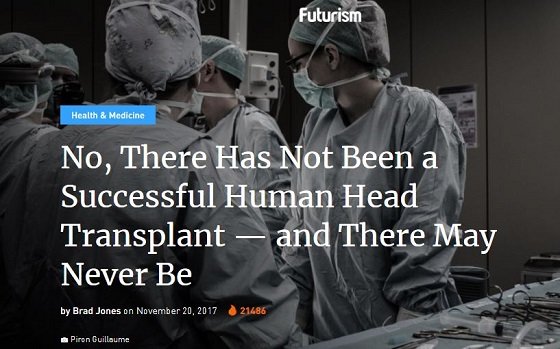 世界初・人間の「頭部移植手術」成功、その後…！頭部切断後に躰は動くのか？の画像3