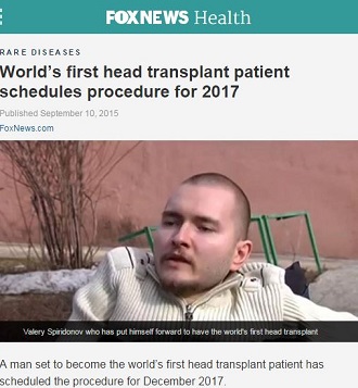 頭と体が別の人間、結合まで36時間 ― 2017年、史上初の頭部移植手術への画像1