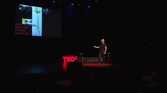 頭と体が別の人間、結合まで36時間 ― 2017年、史上初の頭部移植手術への画像2