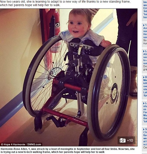 4時間で全身が紫色に…四肢を失った2才の幼女 ― 高致死率の髄膜炎の恐怖の画像2