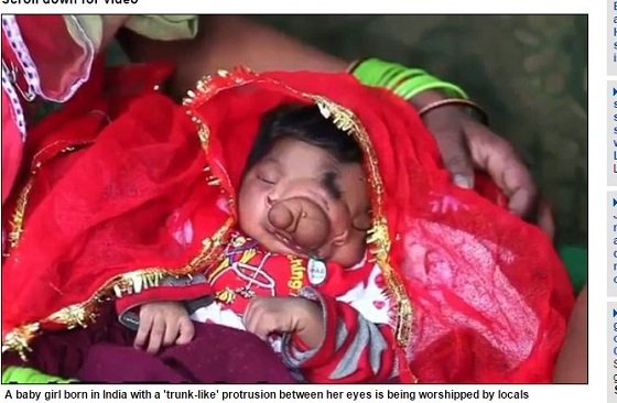 神の生まれ変わりか？「ガネーシャの妻」と名付けられた奇形の赤ん坊＝インドの画像2