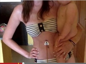 7年間食事をしていない女性 ― 胃不全麻痺の恐怖の画像2