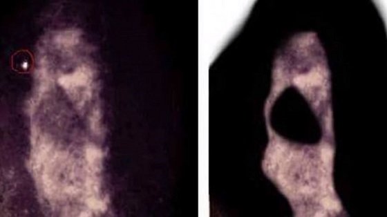 「イギリスで最も呪われた家」がただ今売出し中！ フロア血の海、脇腹に蹴り…リアル・シャイニングが体験可能？の画像2